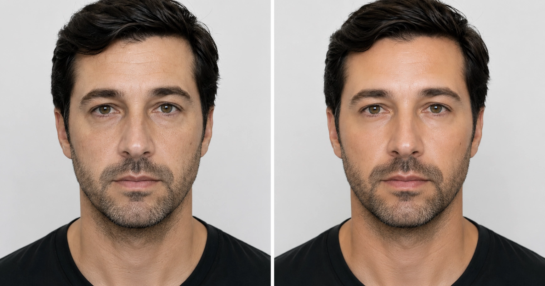 Entenda os benefícios do Skinbooster